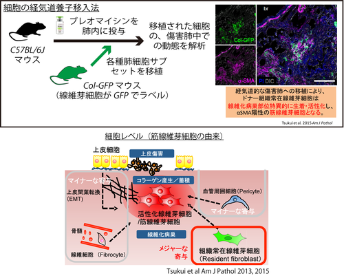 Project On Chronic Inflammation Fibrosis 東京理科大学研究推進機構 生命医科学研究所 炎症 免疫難病制御部門 松島研究室